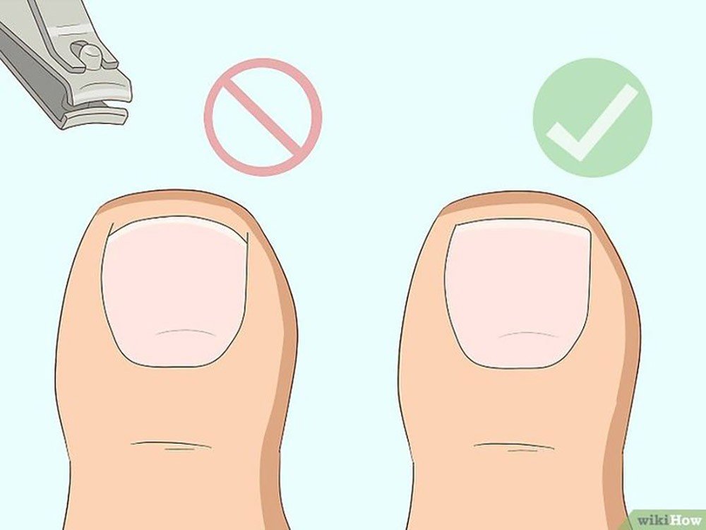 Как правильно подстричь ногти на ногах ребенку