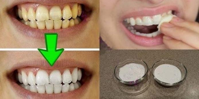 Отбеливание желтых зубов менее чем за 2 минуты!