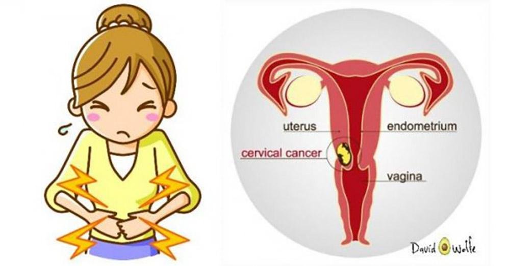 Большинство женщин сразу не замечают 3 признака рака шейки матки!